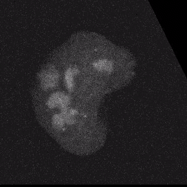 Live cell imaging showing AAV DNA concatenation